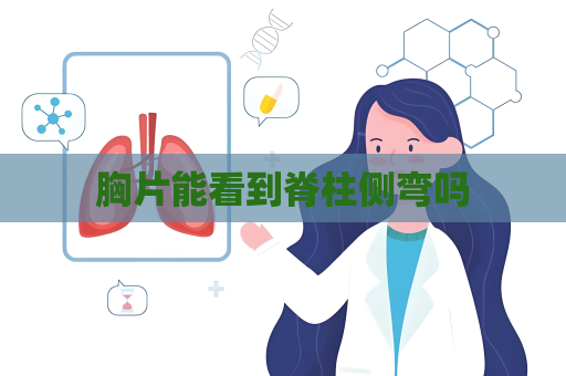 胸片能看到脊柱側(cè)彎嗎