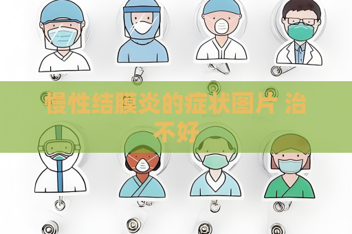 慢性結膜炎的癥狀圖片 治不好