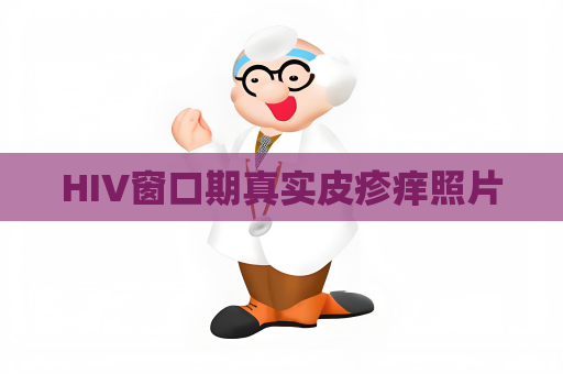 HIV窗口期真實皮疹癢照片