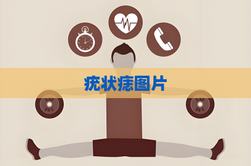 疣狀痣圖片
